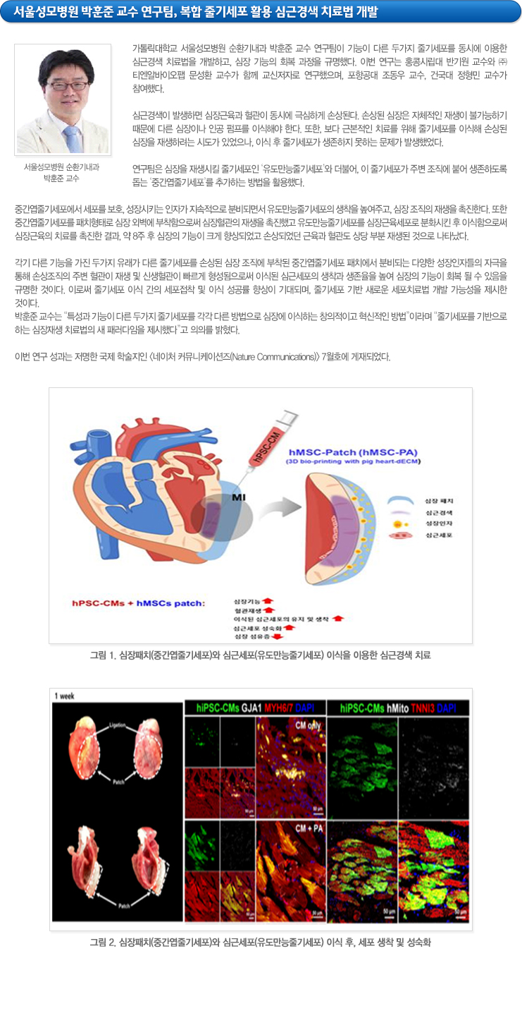 하단참조